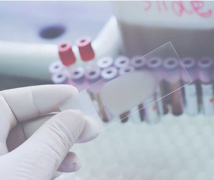 Teaser Bluterkrankung