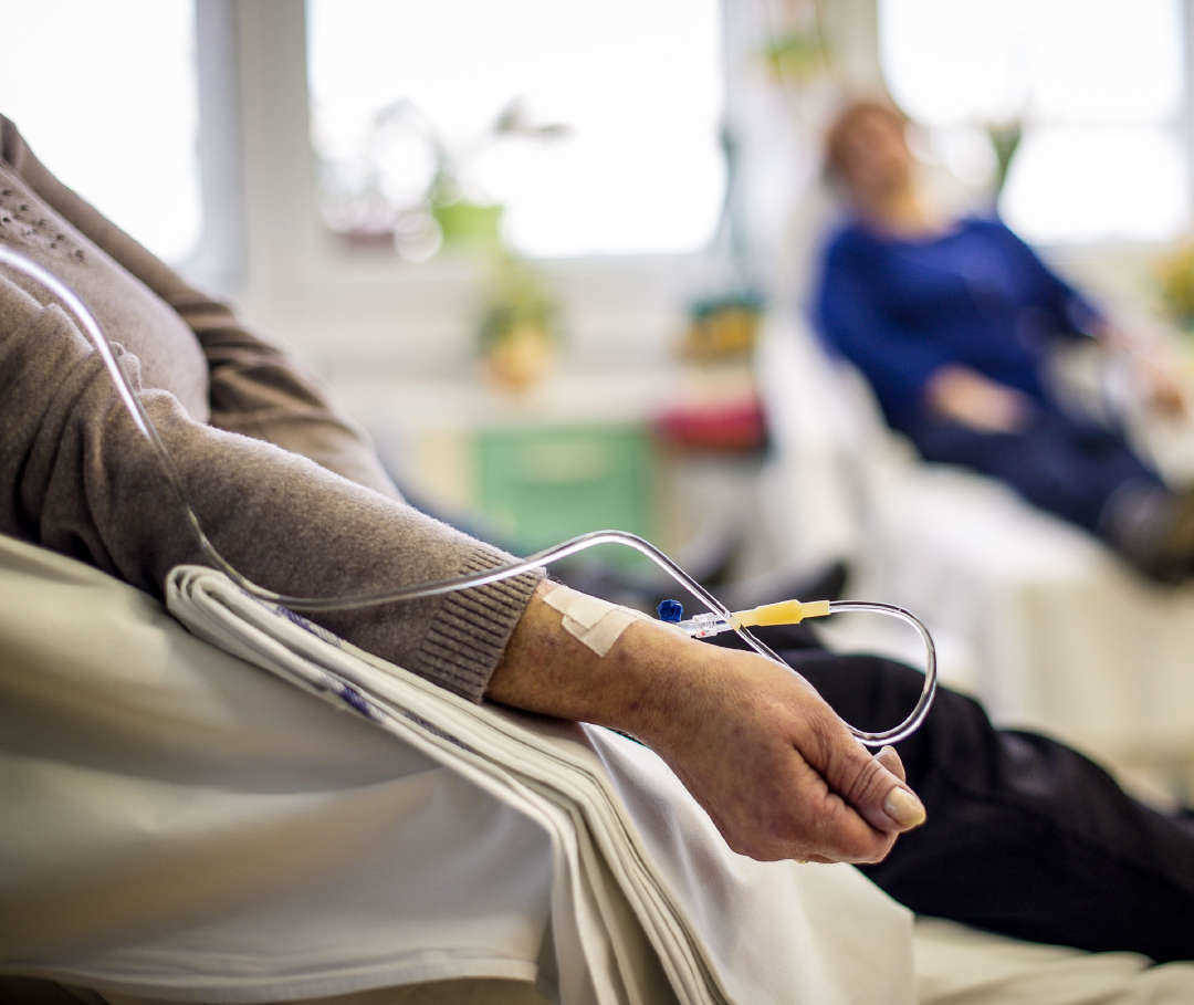 Behandlungsmöglichkeiten dlbcl