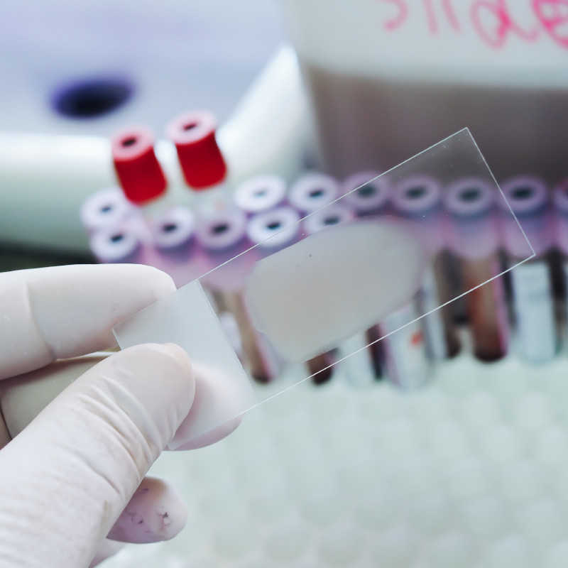 Blutuntersuchungen Blutuntersuchungen