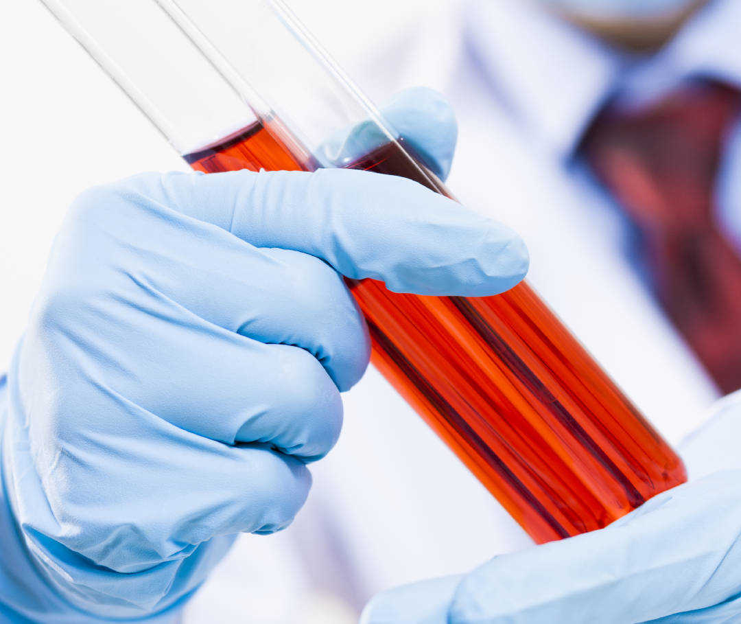 Blutanalyse Blutanalyse